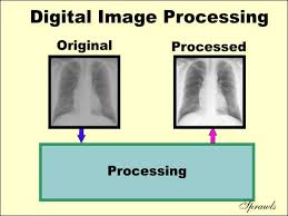 Image Processing in Medical